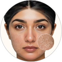 Dull/flakiness/lifeless looking skin