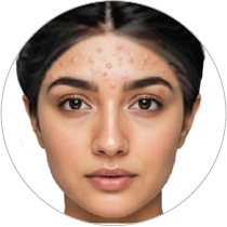 Tiny bumps on forehead