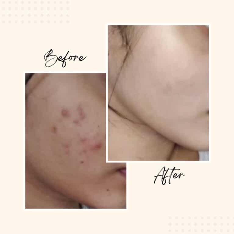 before after images _20260110_183539_0000